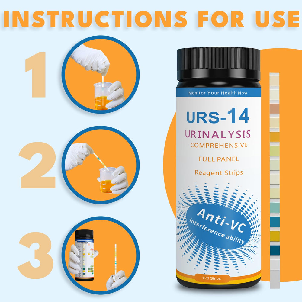 Color chart reference for URS test strips