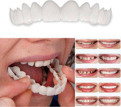 Close-up of white smile aligners for at-home use