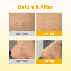 Acropass dermatologist-tested badge indicates safety and efficacy focus.