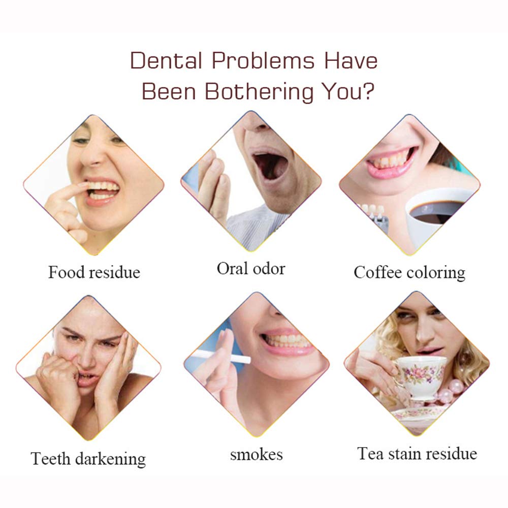 Close-up of teeth with whitening toothpaste