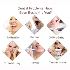 Close-up of teeth with whitening toothpaste