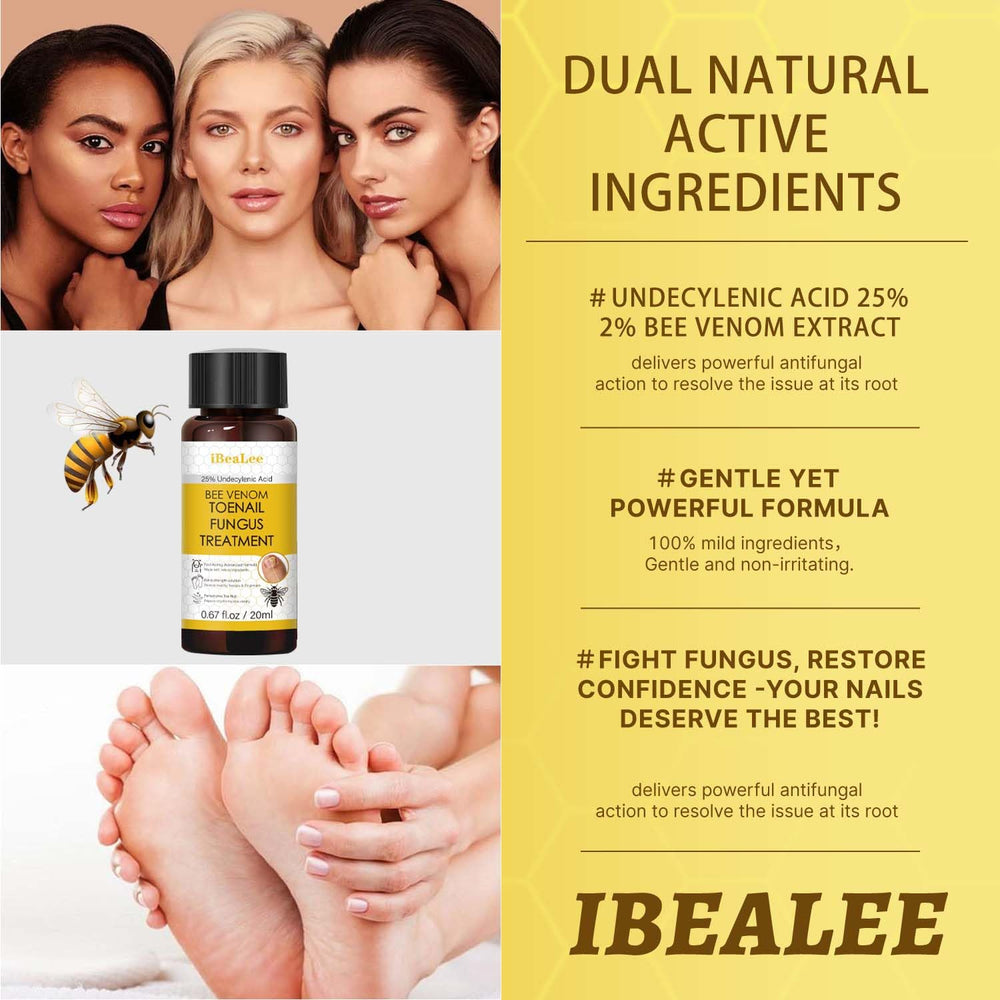 Aimery Bee Venom Antifungal Solution on ingrown nail demonstrates precise fungal care.