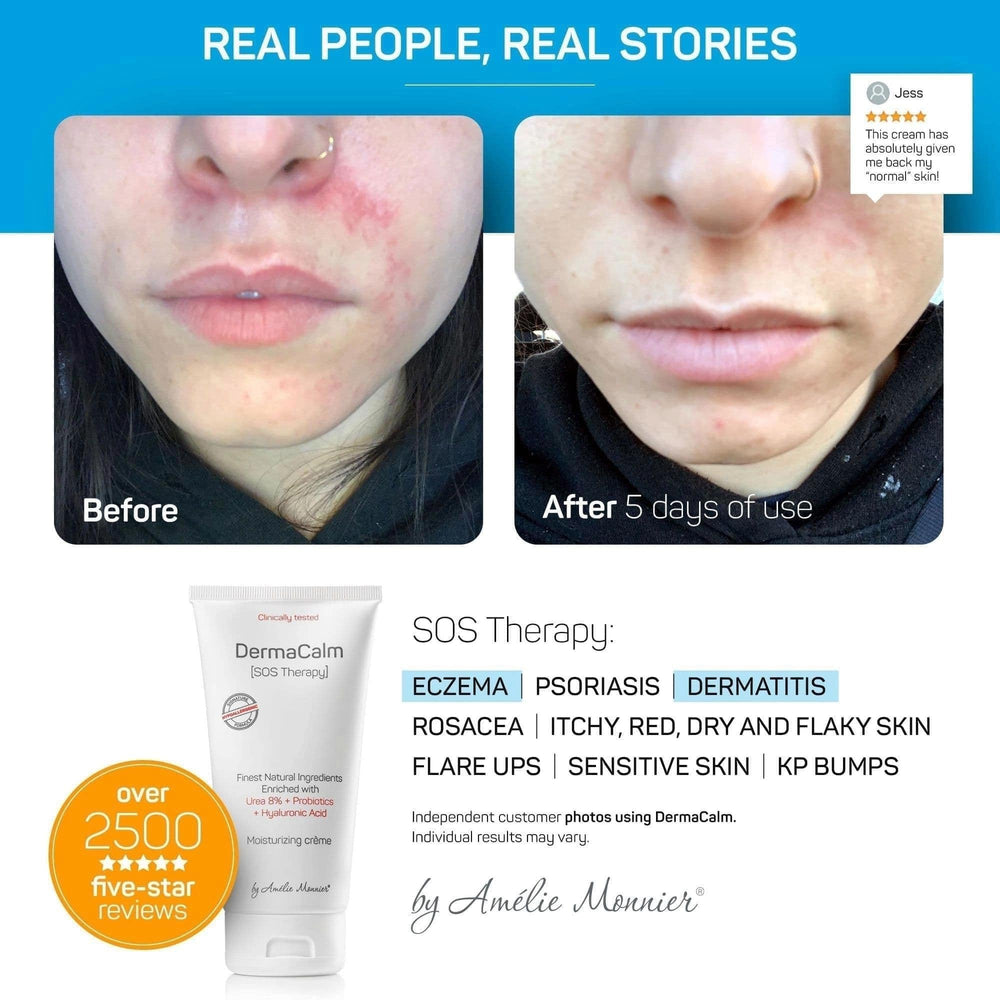 Cream texture showing rich moisturizing blend with urea and hyaluronic acid