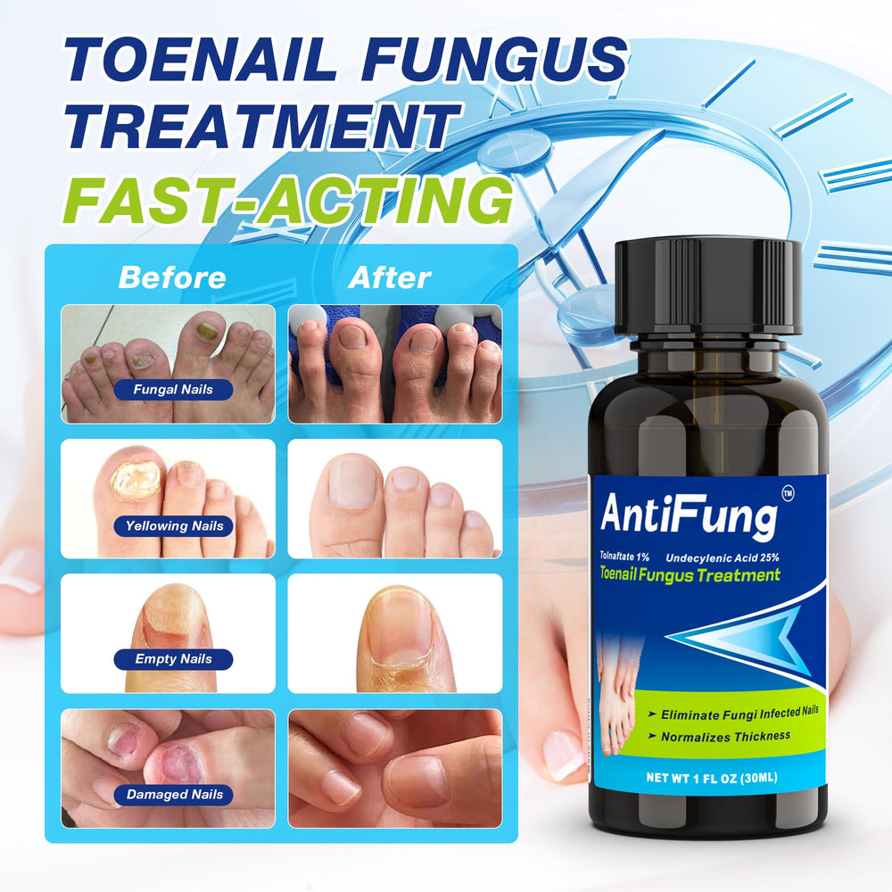 AntiFung tea tree oil blend highlights natural antifungal power for nails