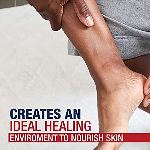 Cracked feet use case with Aquaphor application