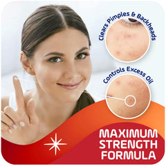 Asepxia drying formula on blemish application highlights gentle, targeted relief.