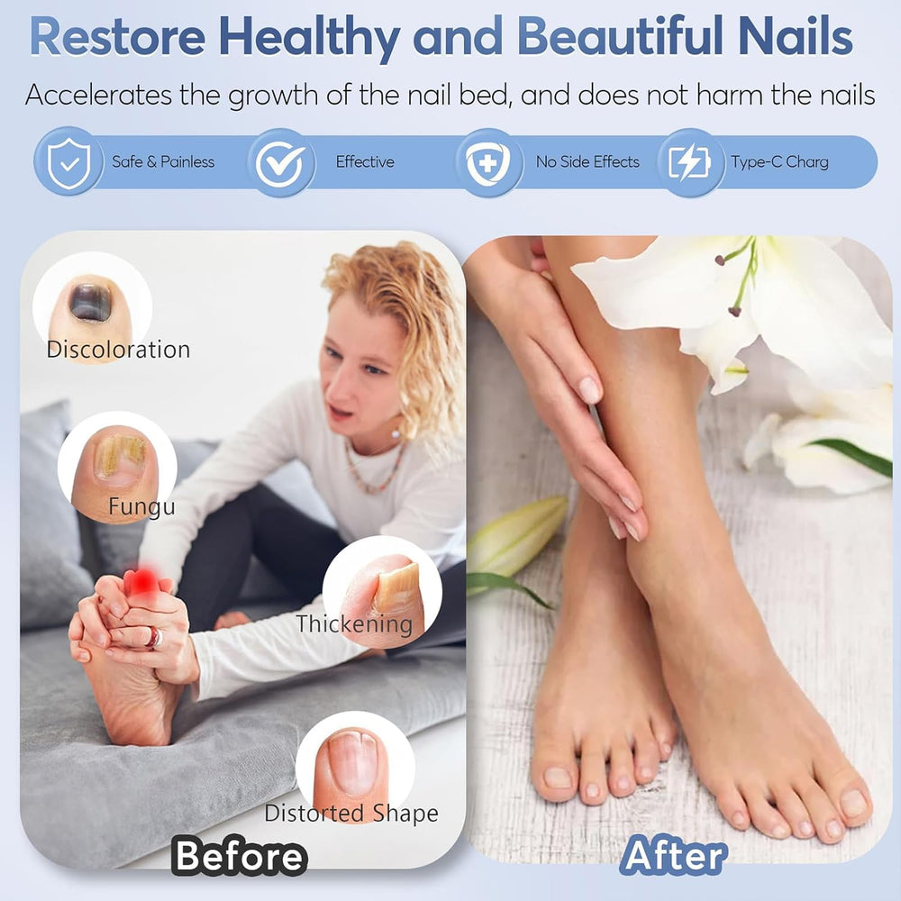 ASLAWU nail fungus laser device recharge port for convenient home use.