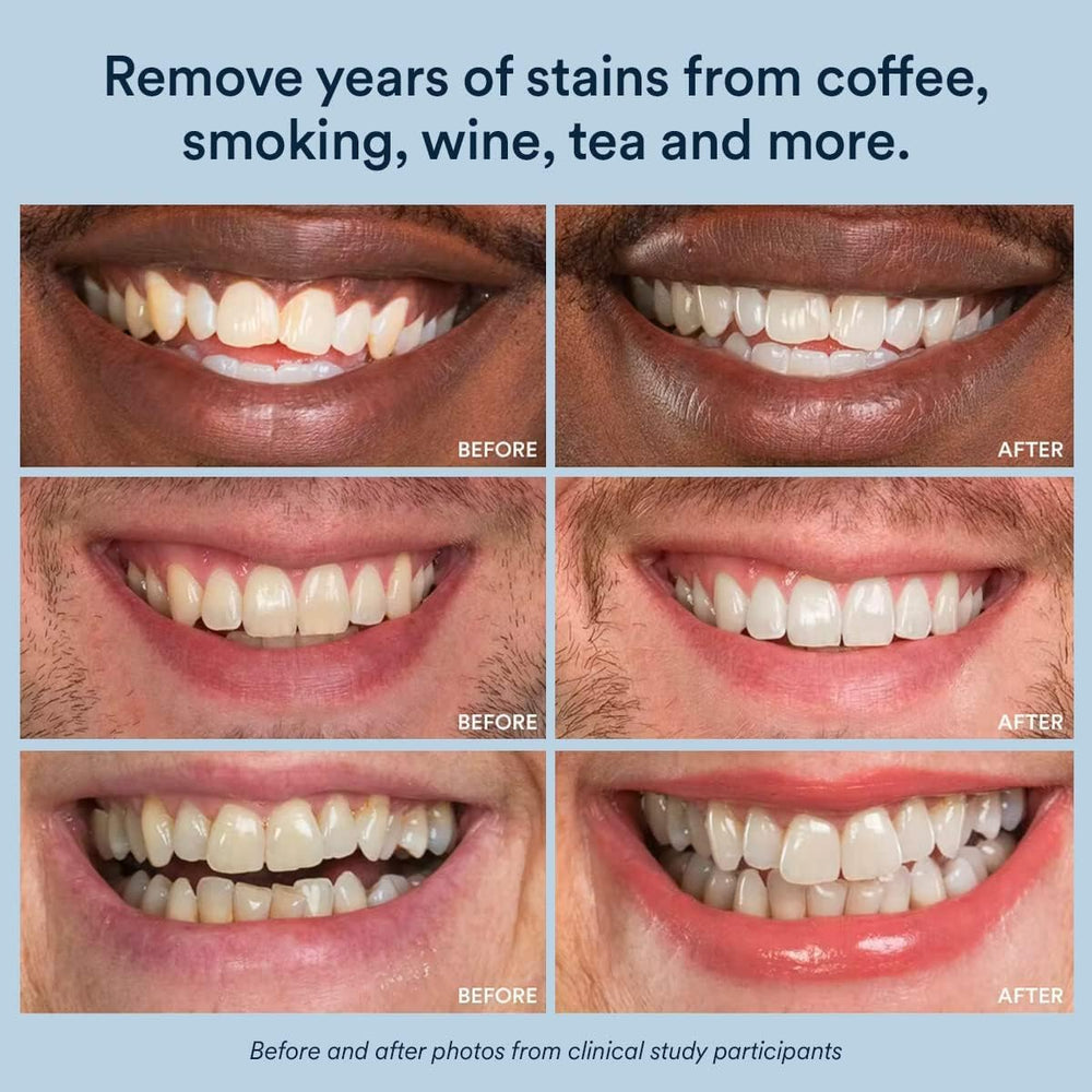 Packaging showing 14 treatments and 28 strips included
