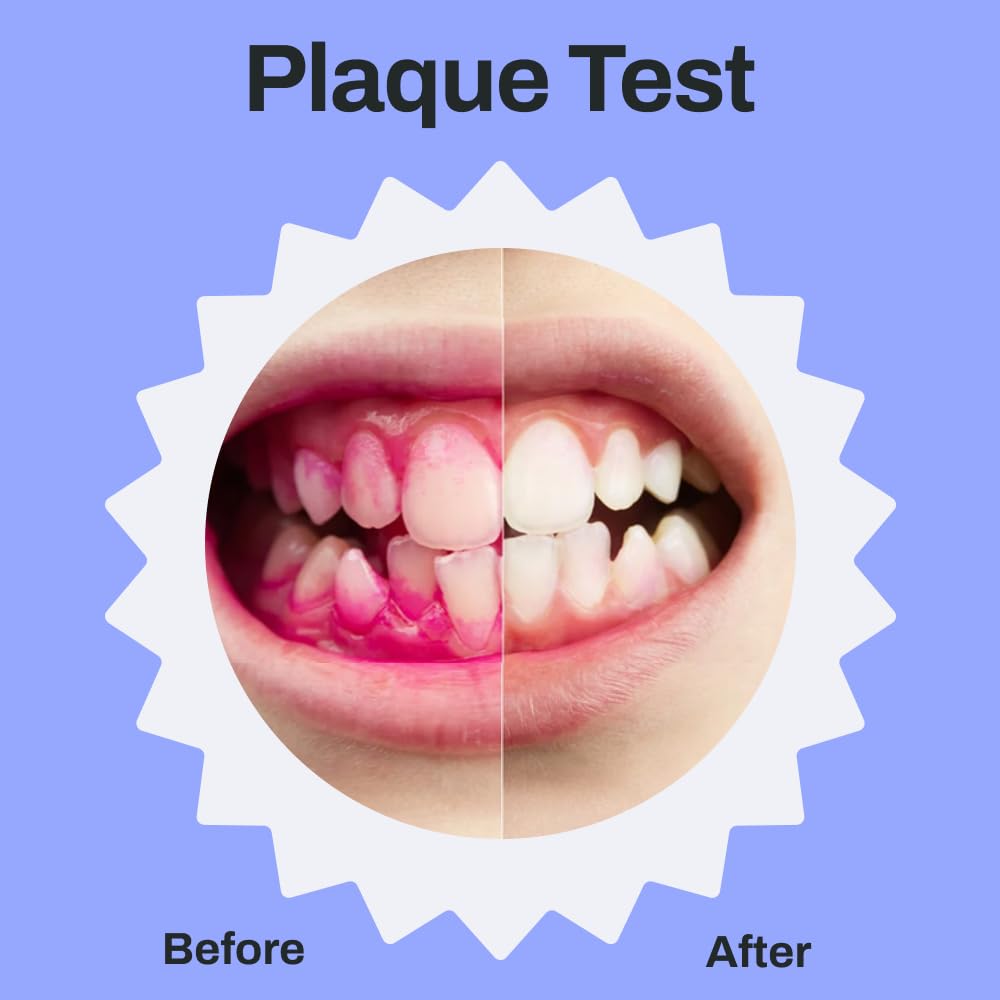 Illustration of 360-degree full-mouth coverage
