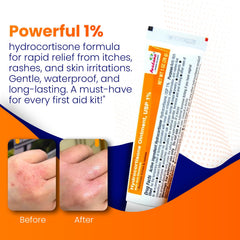 Close-up of AVEDANA label showing 1% hydrocortisone strength.