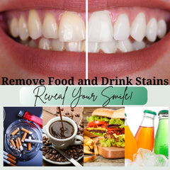 Advice to avoid staining foods and drinks between treatments