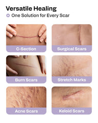 AWD Medical scar tape over post-surgical area supports moisture and protection.
