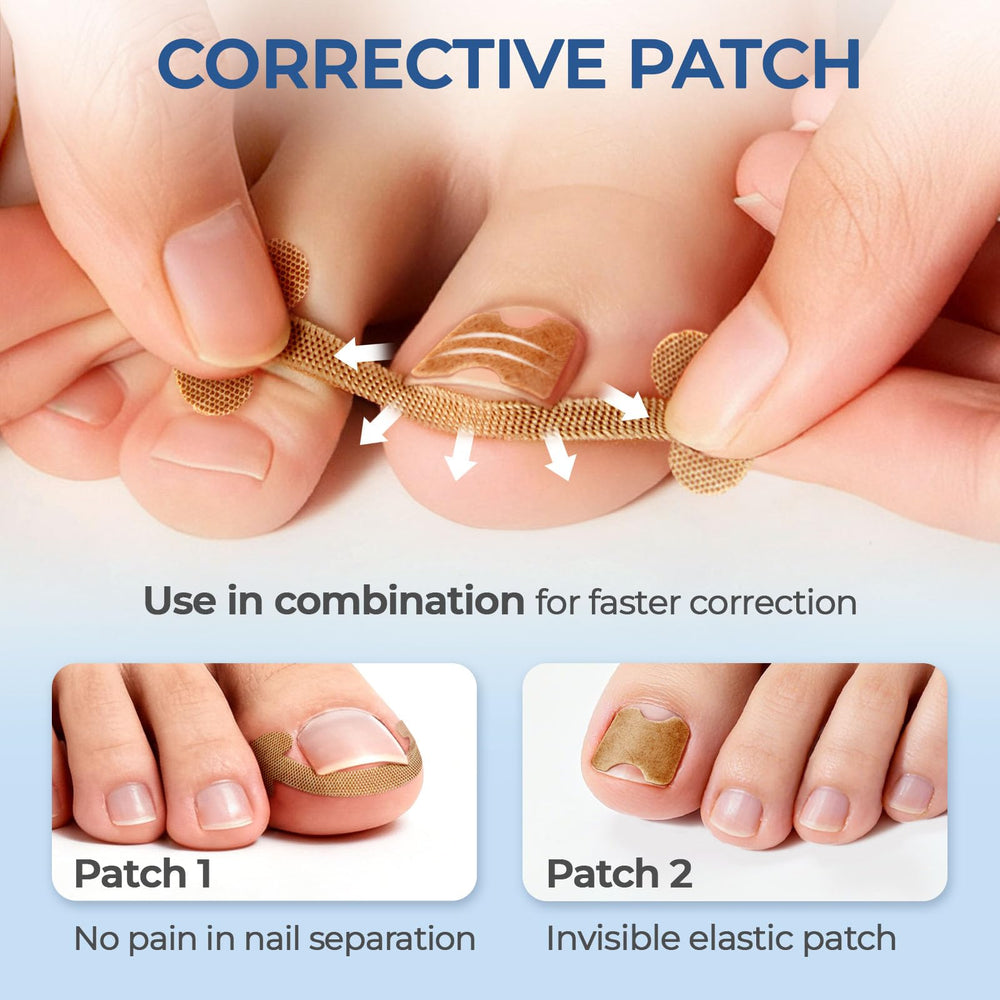 awrose 16 correction strips flexible and trim-to-fit