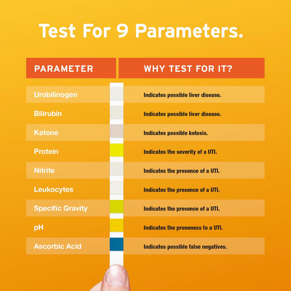 Specific gravity and pH indicators on the 9-in-1 strip