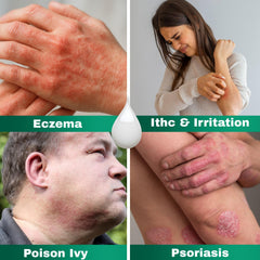 Barmicil Plus Cream with aloe vera signals soothing hydration