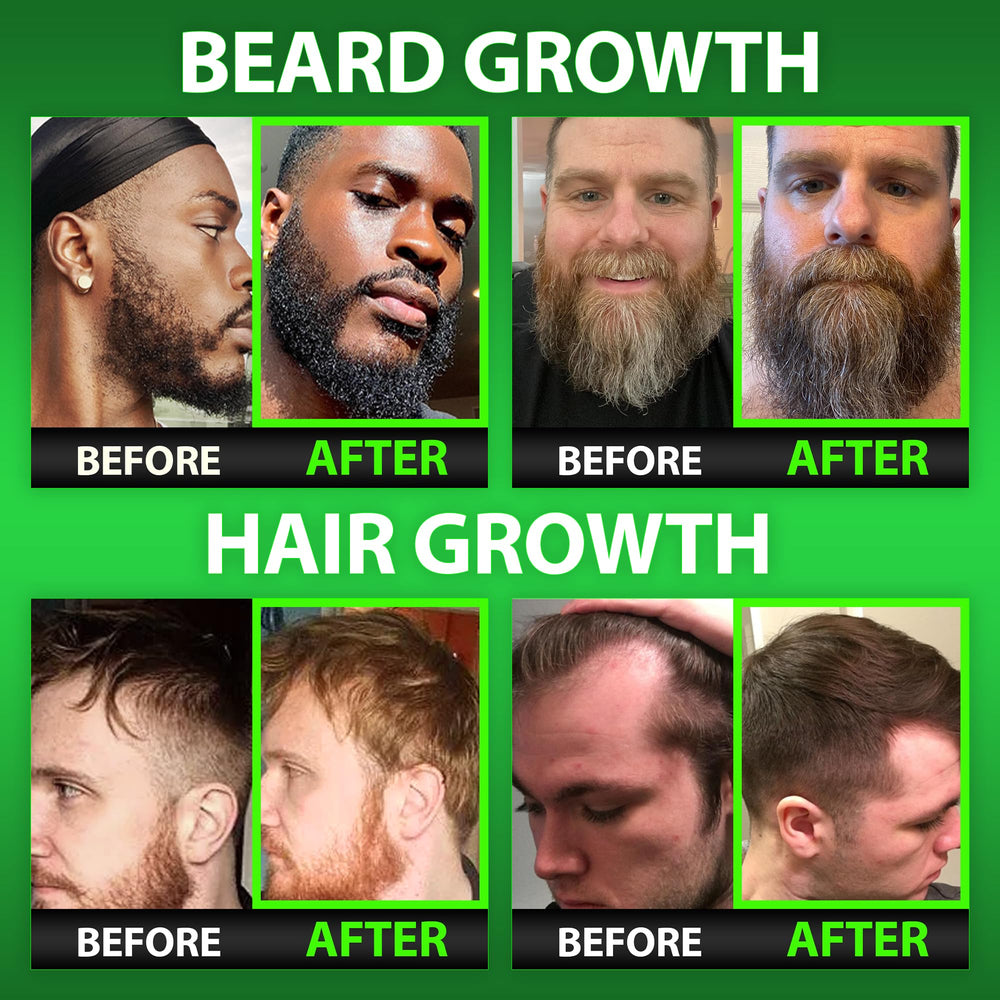 Gummies close-up highlighting chewable texture and beard growth support from BBS Best Beard Stuff.