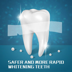 Before and after teeth whitening results