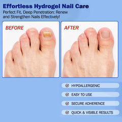 BFGCKJ deep-nail support helps maintain moisture balance in the nail bed