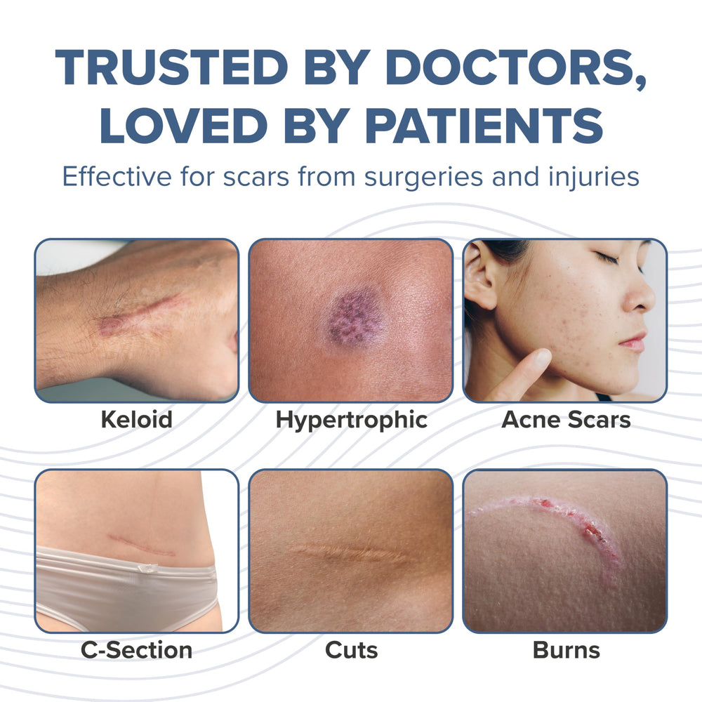 BIODERMIS PROSIL stick travel-friendly packaging supports portable scar therapy.