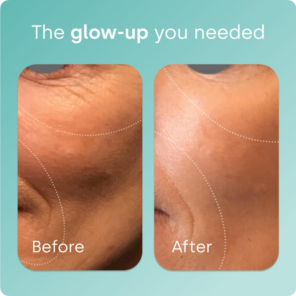 Biosil Collagen Booster bottle showcasing the label