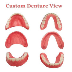 Denture restoration kit components laid out