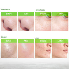 Blooskim gentle exfoliation without beads yields smoother skin.