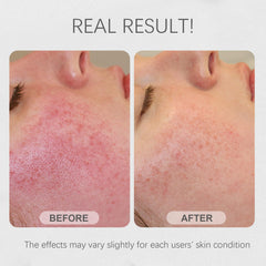 Bmrewax Rice Mask promotes natural glow and refined pores.
