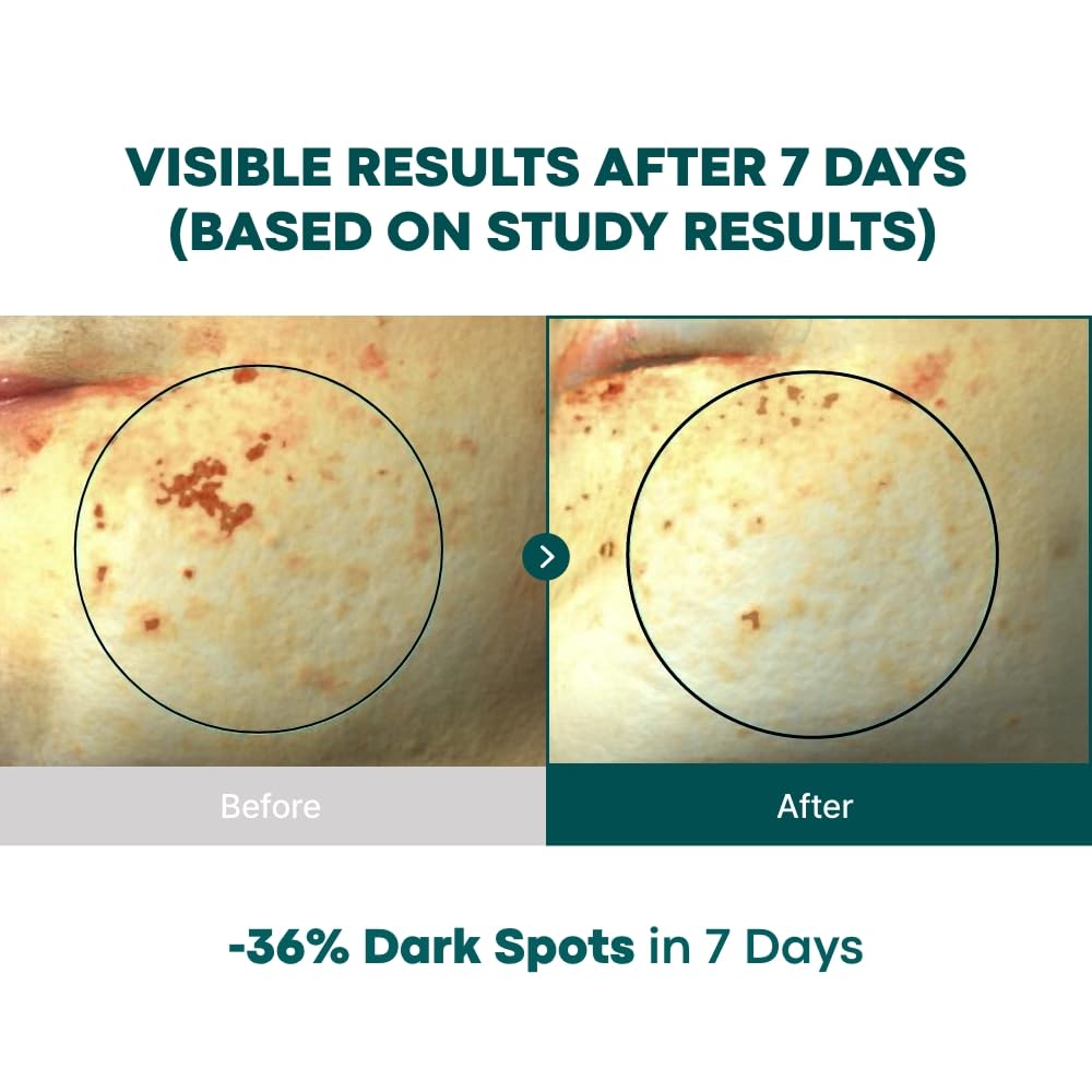 BONCEPT Vita C serum texture showcases light non sticky hydration upon application