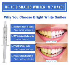 Whitening gel syringes ready for LED light use