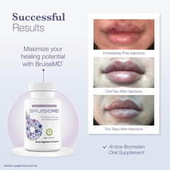 BruiseMD trusted by dermatology professionals