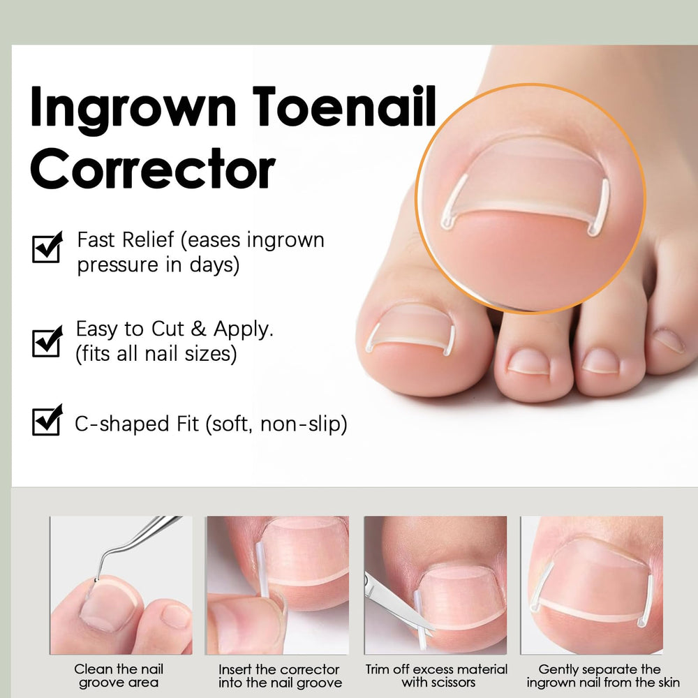 Callmynm nail edge lift in action demonstrates progress toward natural growth safely