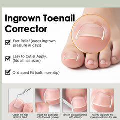 Callmynm nail edge lift in action demonstrates progress toward natural growth safely