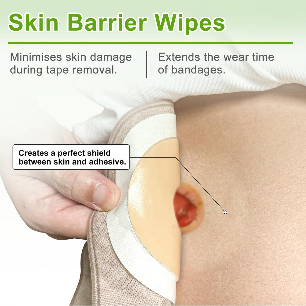 Carbou Skin Barrier Wipes demonstrate adhesion boost for adhesives