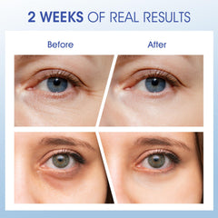 Ceedoo Eye Cream with caffeine brightens under-eye area