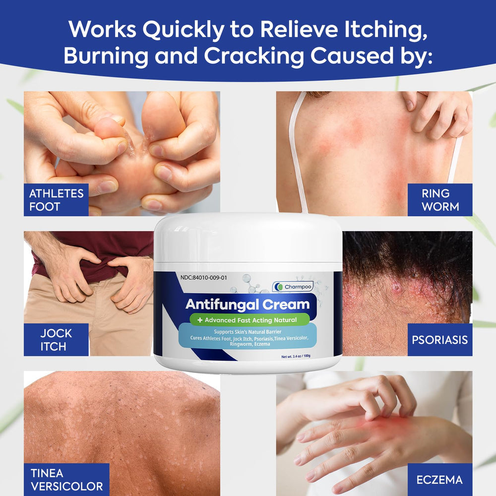 CHARMPOO antifungal cream tube close-up shows easy-dispense design for quick itch relief.