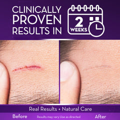Cicatricure Advanced Scar Gel packaging jar showcases lightweight non-greasy formula