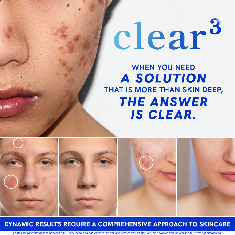 Pill showing zinc, DIM and probiotics in Clear Skin Supplement