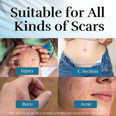 CLNABFR texture-swatch demonstrating creamy gel formula for sensitive scars.