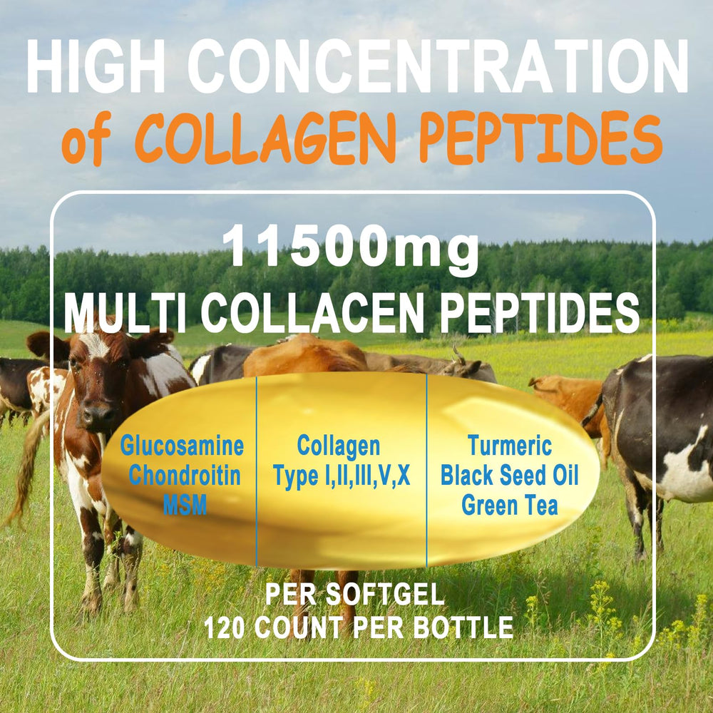 Antioxidants, Omega-3 and Boswellia in formula