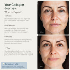 Hydrolyzed collagen for fast absorption