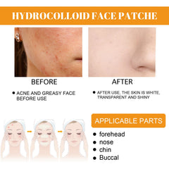 Coweroay cheek patch variant for full-face blemish coverage and texture balance.