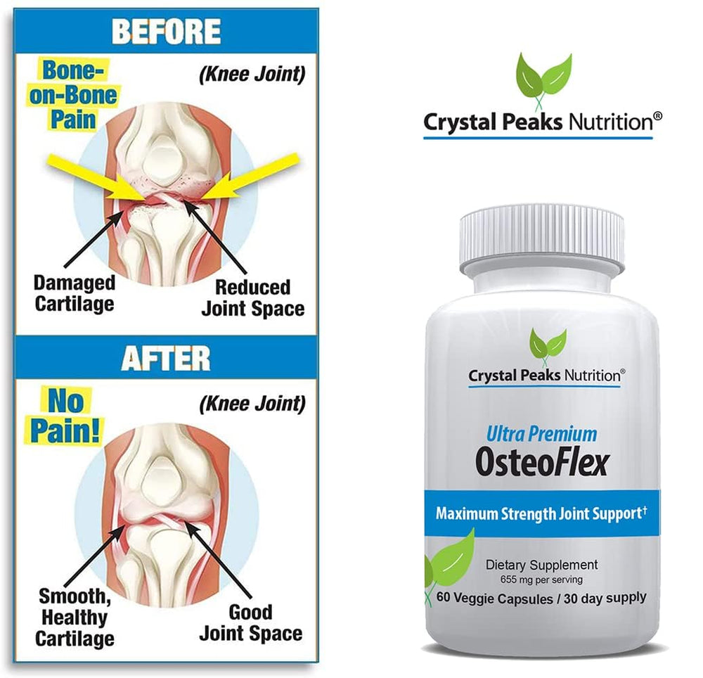 OsteoFlex product highlighting 95% curcuminoids