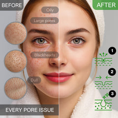 DAAZZS Loop Extractor Tools, precise extraction for clearer pores