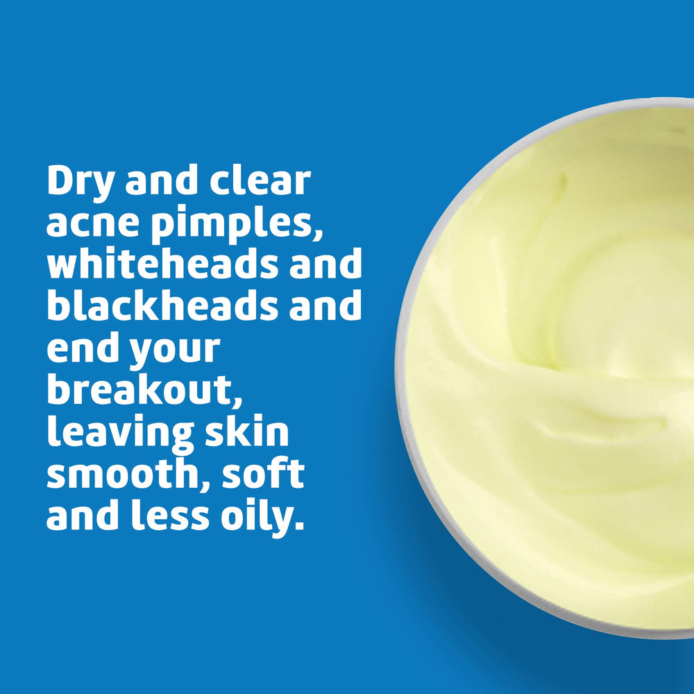 Close-up texture of De La Cruz Sulfur Ointment for smooth application.