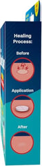 Close-up of mint-flavored canker sore relief tablets