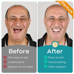 Step-by-step denture assembly and fit process.