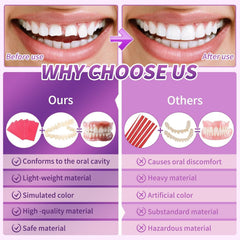 Upper and lower dentures aligned for a DIY smile