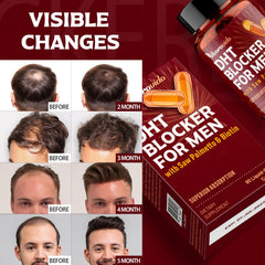 Natural herbal extracts in DHT blocker for men