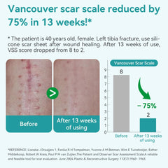 Dimora scar sheet waterproof and shower-friendly for uninterrupted use