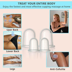 Close-up of XL silicone cups from DoSensePro cupping kit